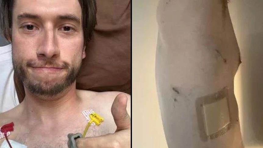 Vaper experiences alarming symptom before lung collapses after bubble bursts inside of him