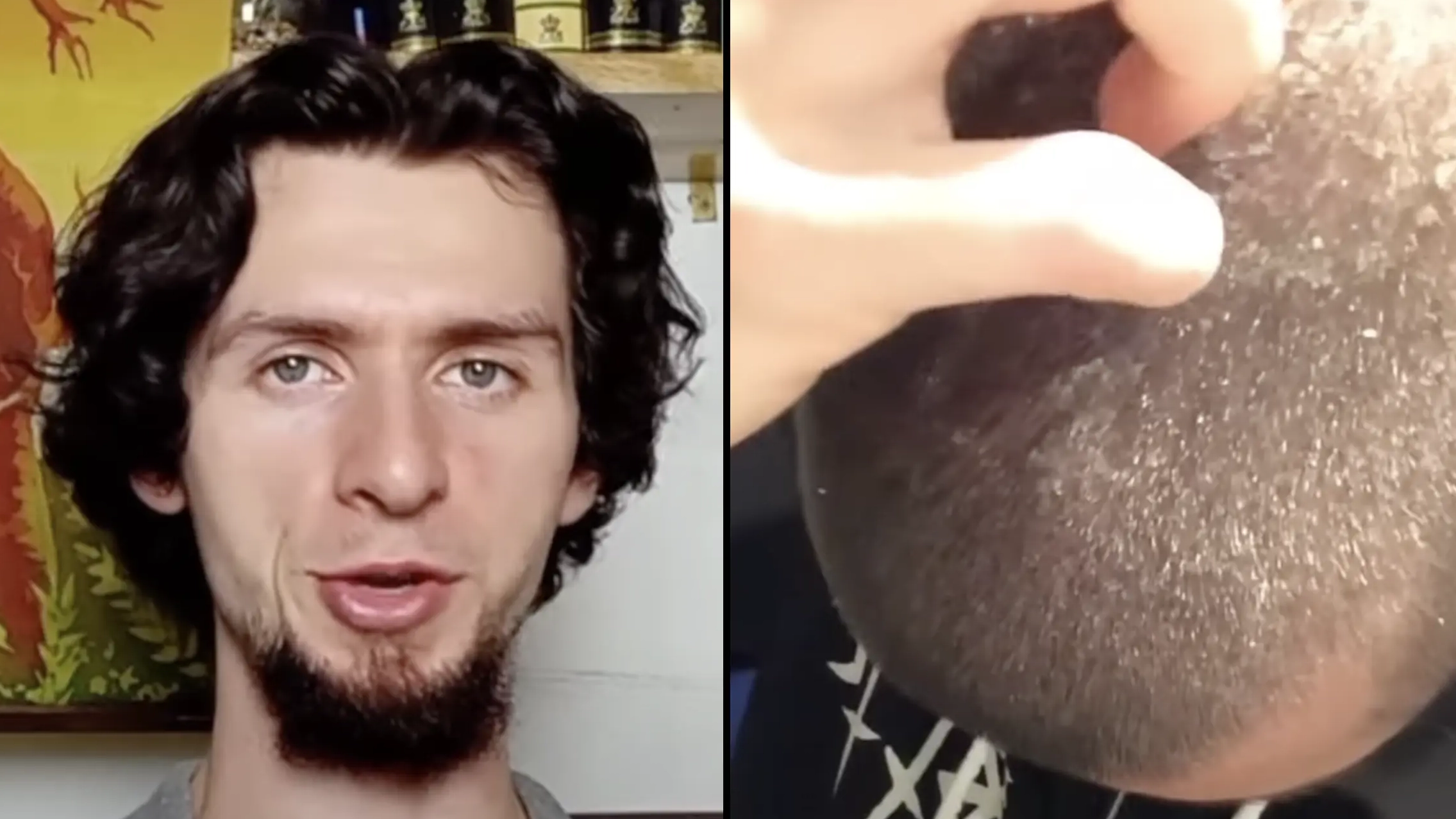 Man who hasn't used shampoo for eight years shows off remarkable results