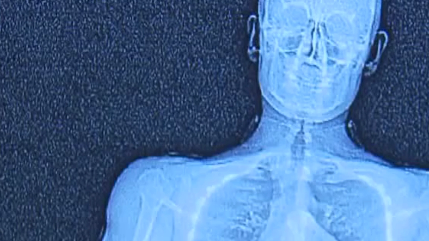 People shocked after seeing what jail X-ray scanner can really see