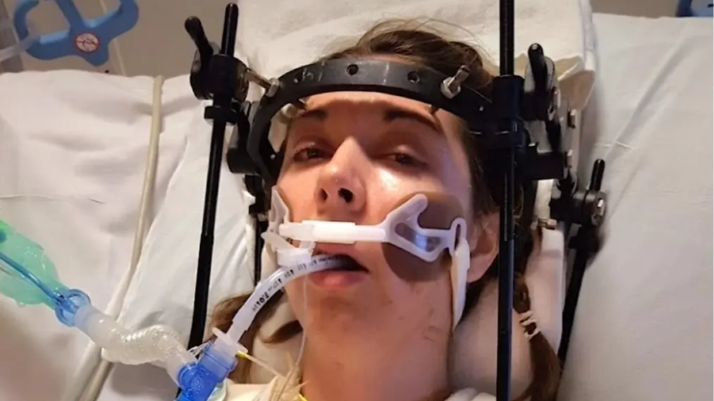 Woman whose head was 'decapitated' following 'horror' accident has it successfully reattached