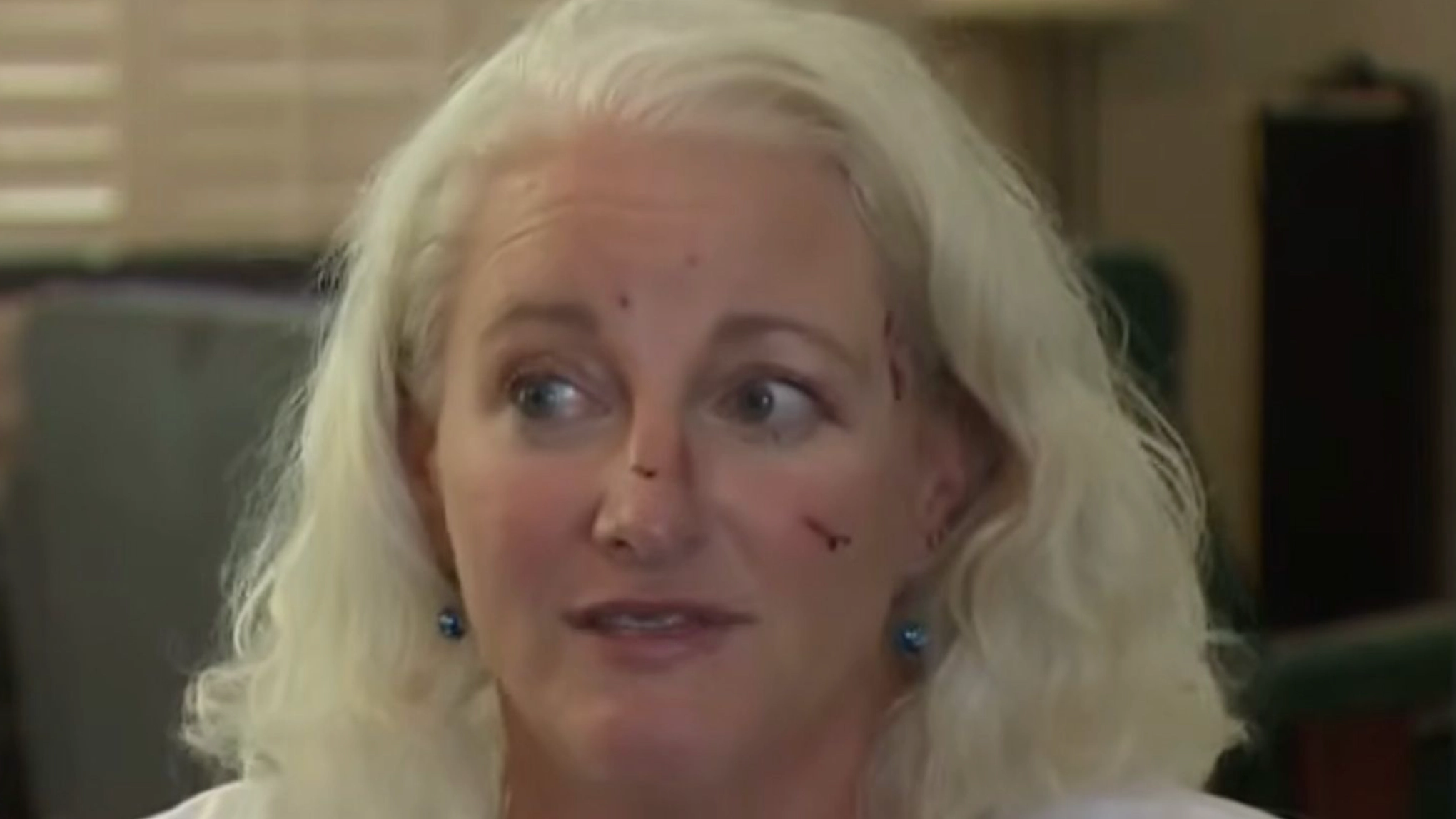 Woman left needing 38 stitches after being attacked by ‘relentless’ otter while swimming