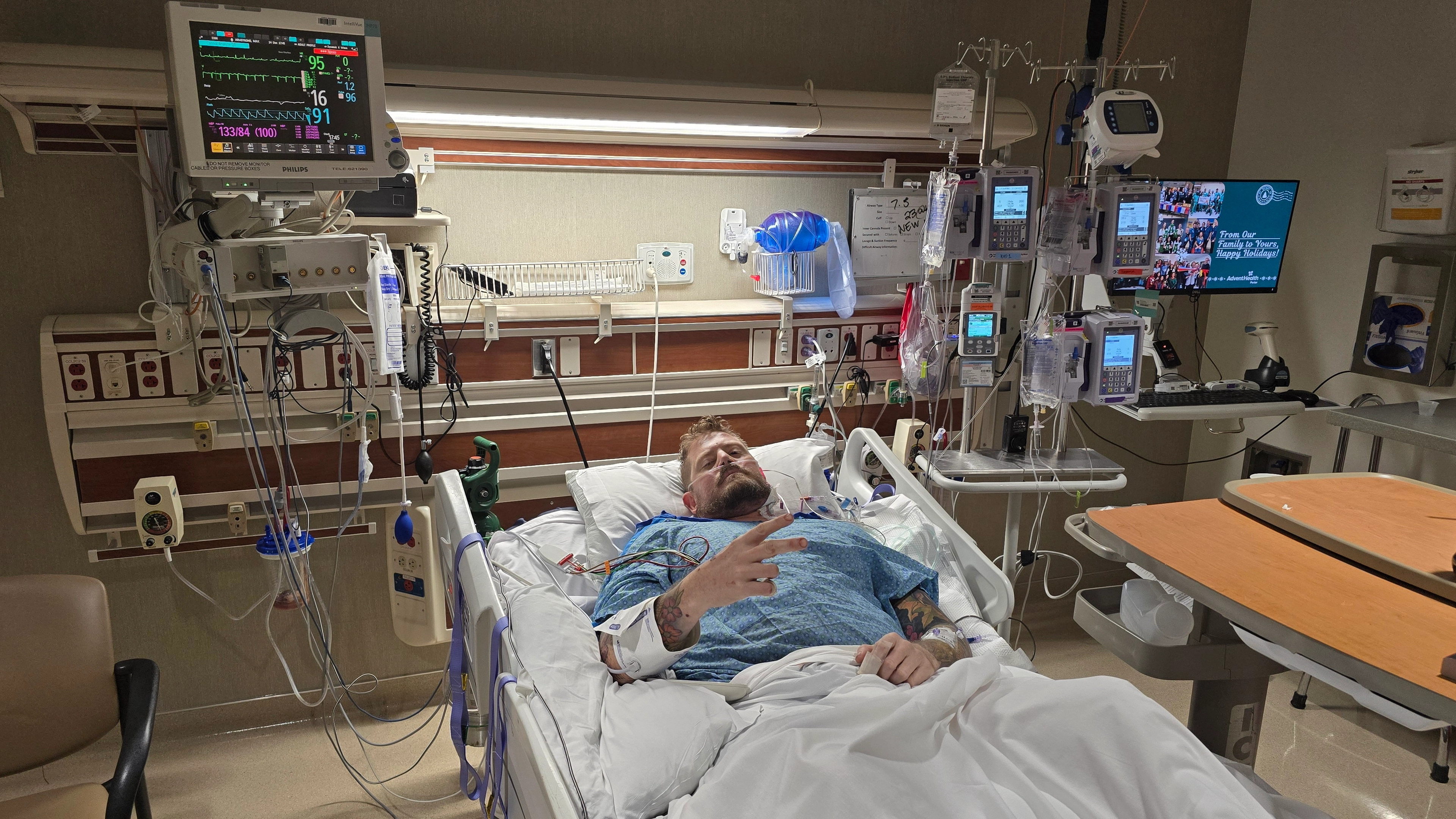 Strep A bacteria explained as man was told he needed both legs amputated after burning his thumb