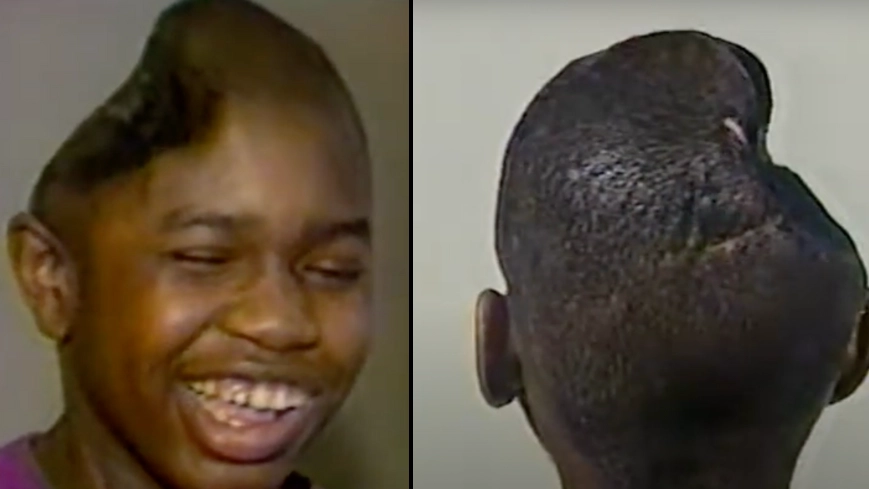 Man who amazed doctors after he cheated death when he lost half his brain after being shot