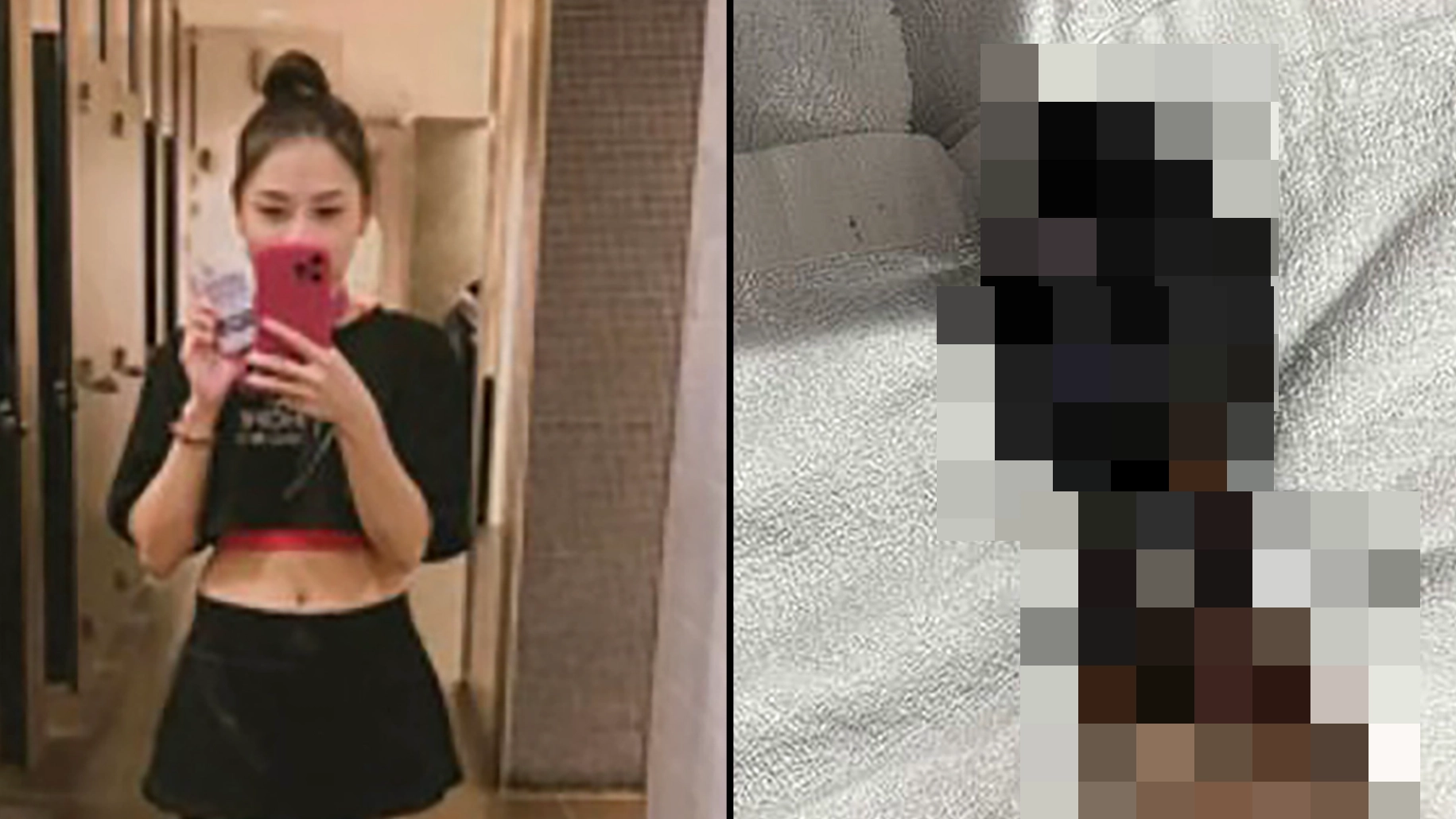 Woman loses hands and legs after suffering with freak condition that left them turning black
