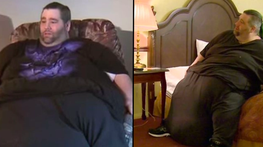 Man with 80-pound scrotum couldn’t have sex for seven years
