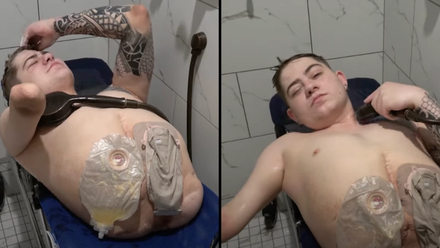 Man who was cut in half by forklift shows how he manages to take a shower despite missing limbs