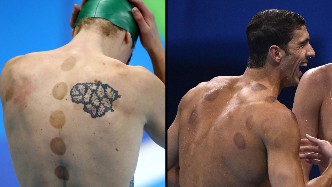 Real reason why some Olympians have dark circles on their bodies
