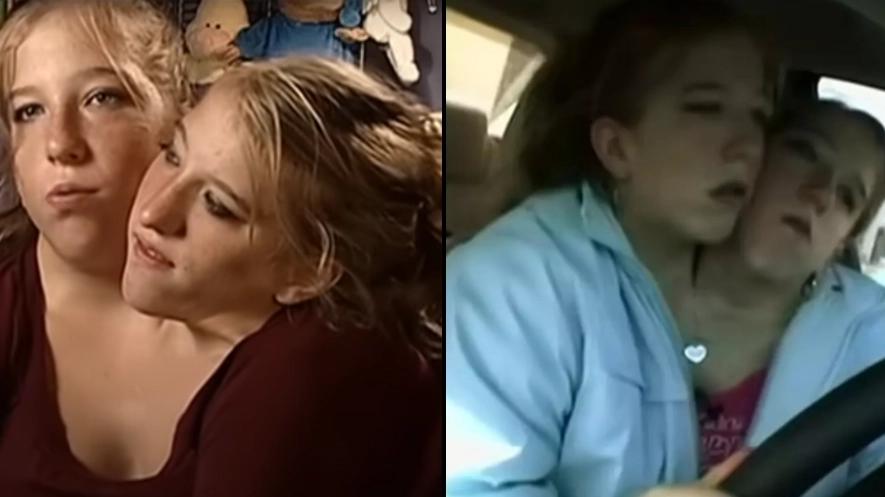 Conjoined twins Abby and Brittany Hensel answered most common questions about how they live their lives