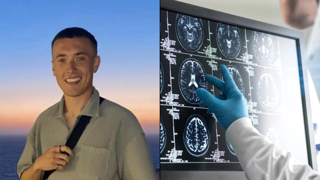 Symptoms of early onset dementia as man discovers he has gene that will develop condition in his 40s