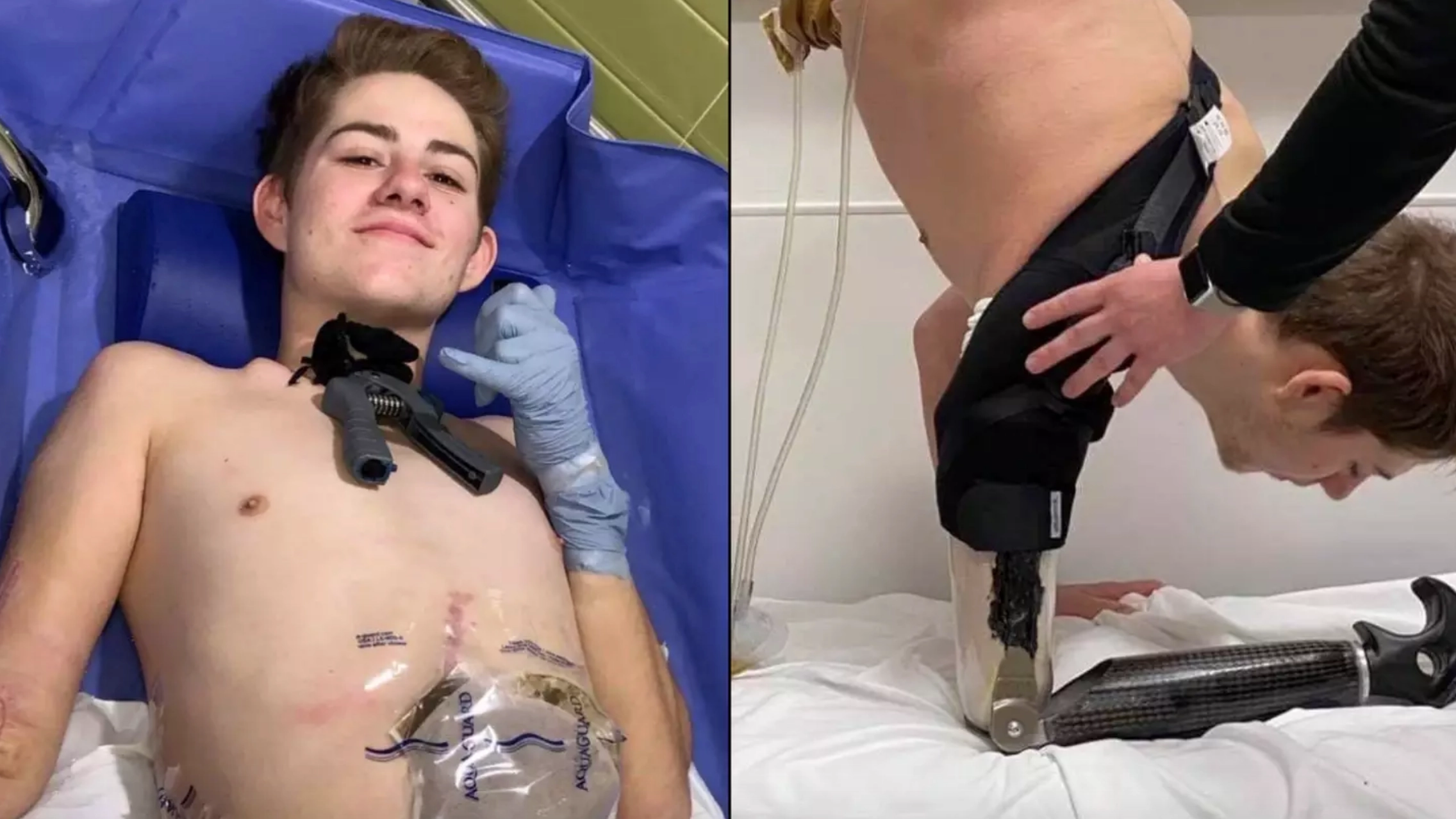 Man cut in half by forklift makes heartbreaking admission about his life since devastating accident