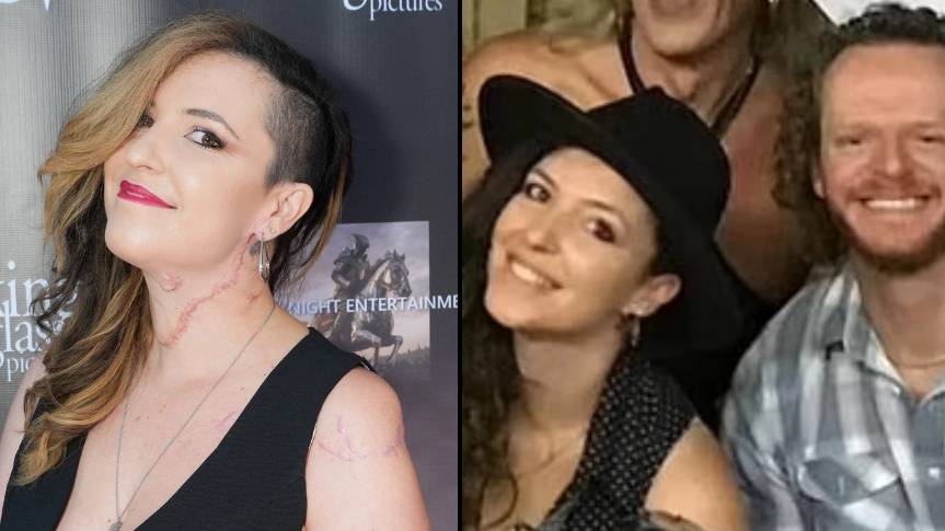 Woman allegedly stabbed 20 times by How I Met Your Mother actor shares scars from attack in public appearance