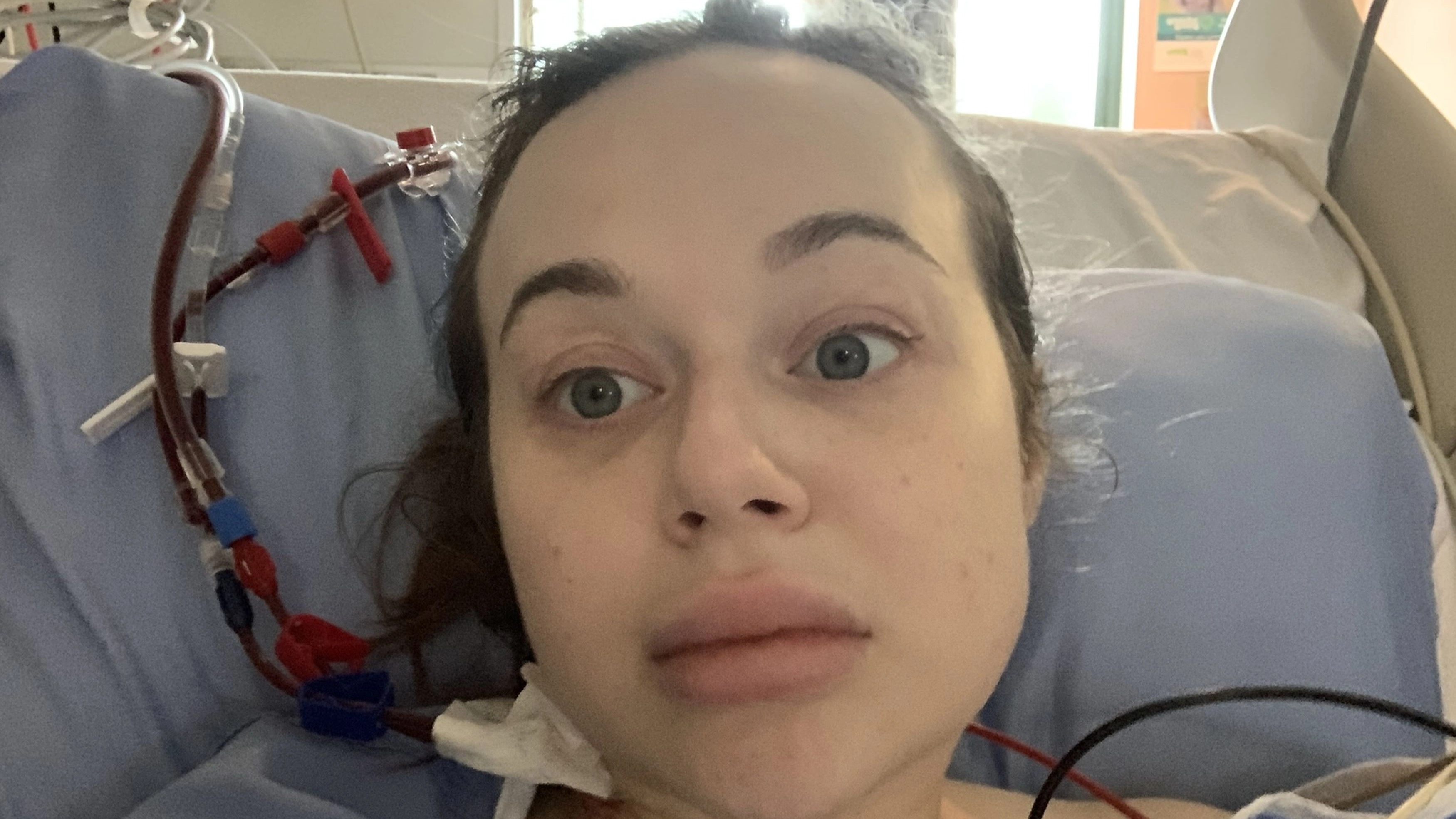 Mum issues serious warning after waking up from night out with ‘legs rotting’
