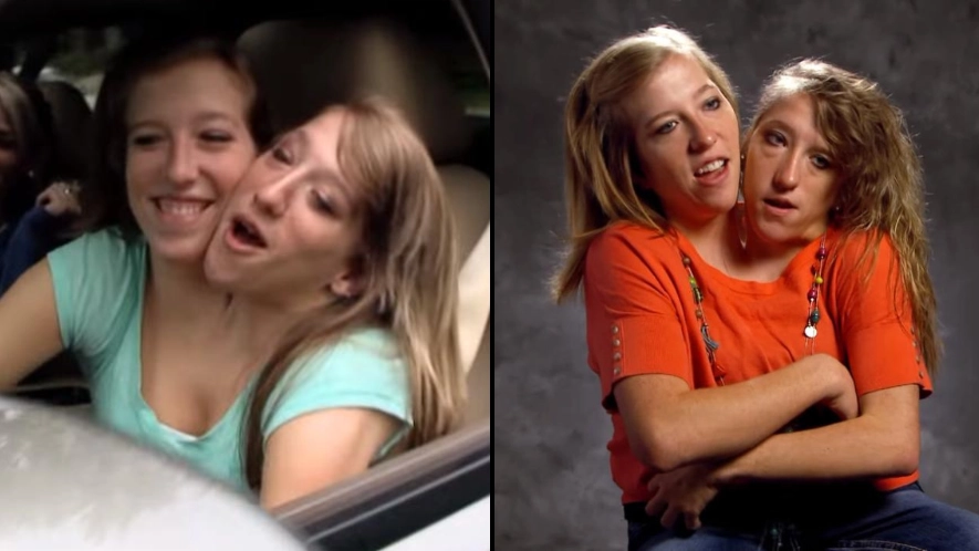 Conjoined twins Abby and Brittany Hensel gave explanation to major question over how they drive a car