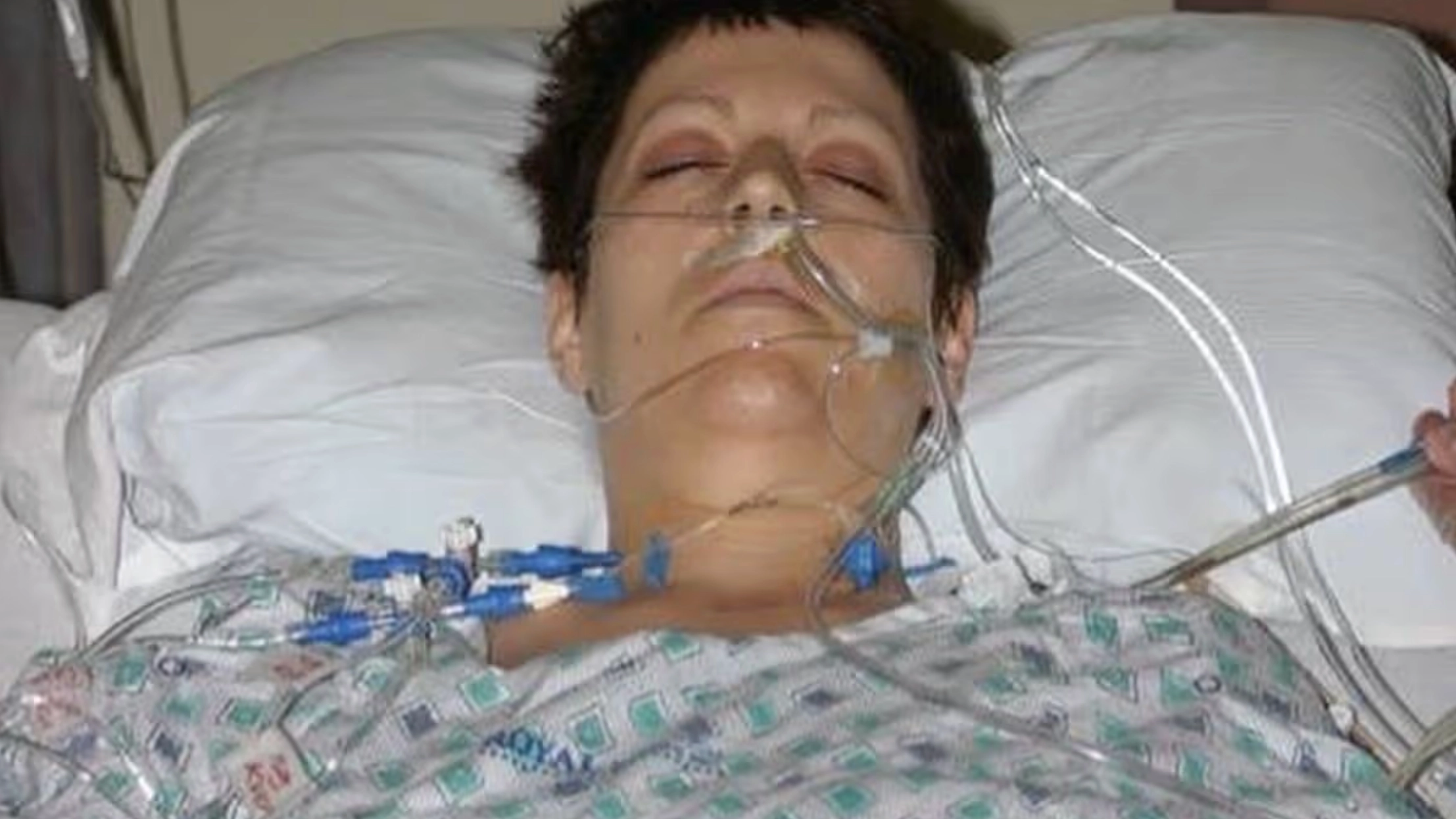 Woman given 15 months to live after wearing her dad's coat gave her cancer