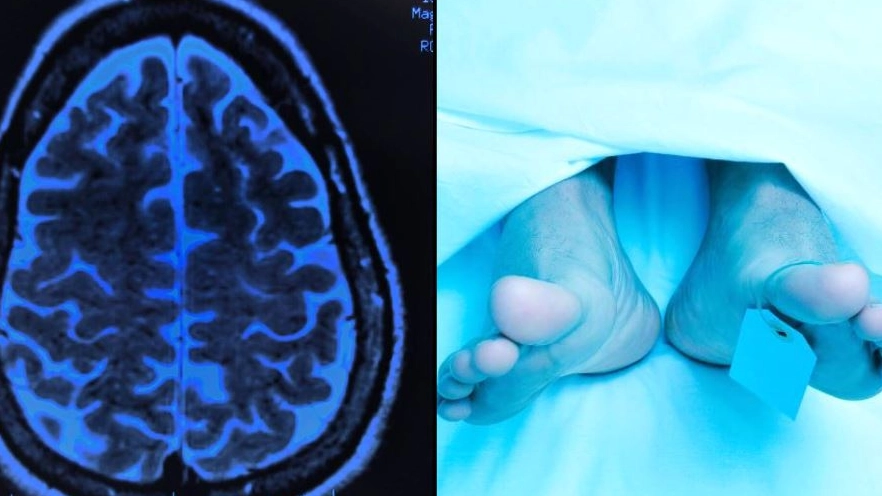Study explains what you may see in final moments before death