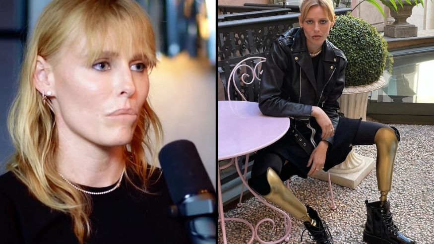 Woman lost both her legs and was minutes from death due to her tampon