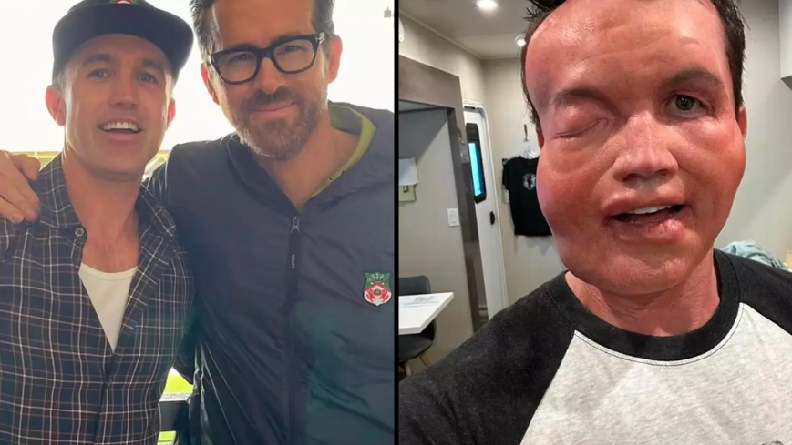 Truth behind Rob McElhenney’s face after New Year’s photo sparks concern