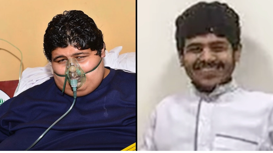 Lad makes incredible transformation after achieving one the largest weight losses ever recorded