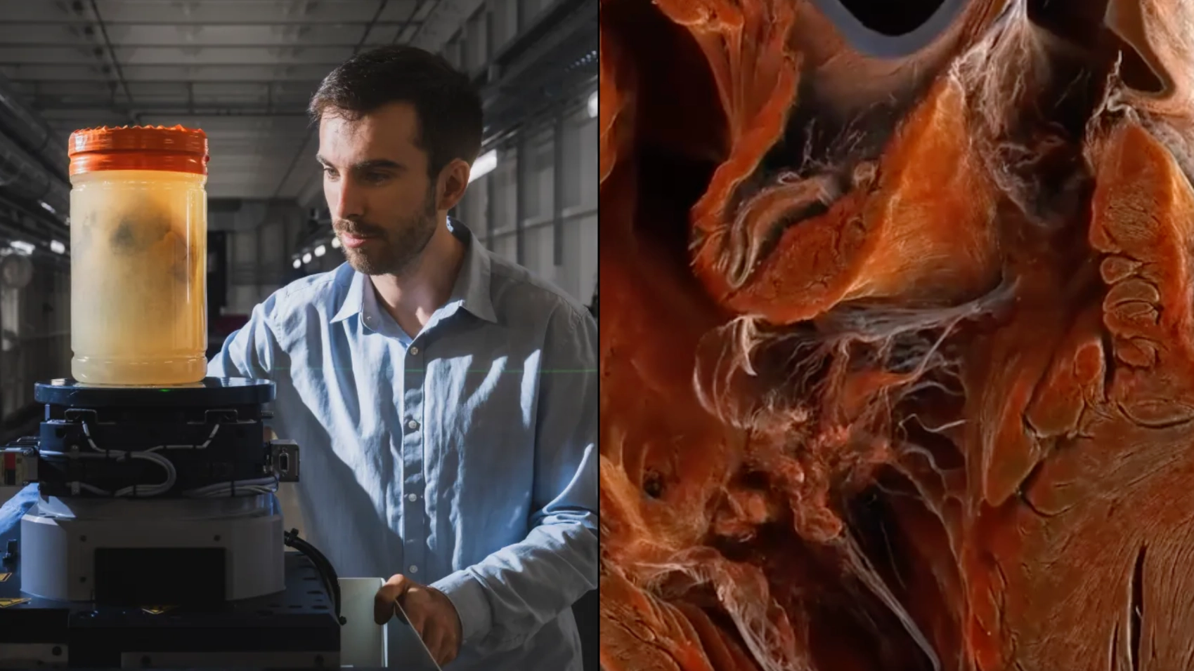 First ever 'Google Earth' organ video shows inside healthy and diseased hearts in extraordinary detail