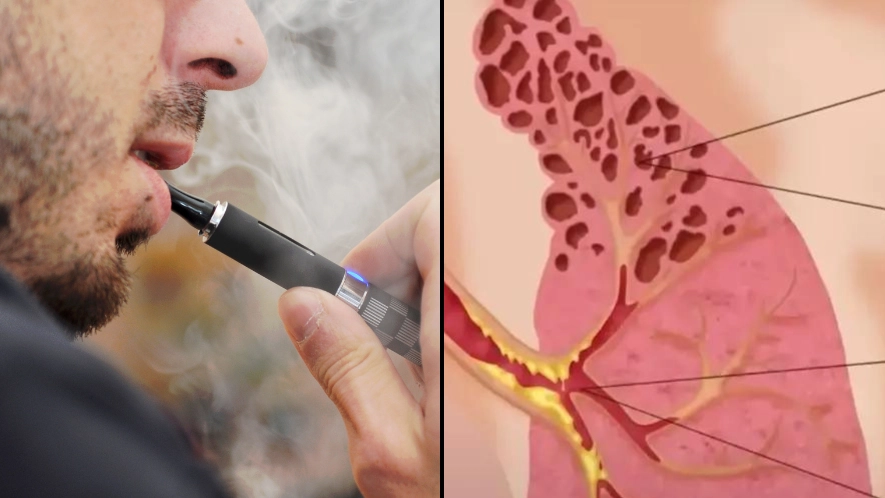 Timeline of what happens when you stop vaping after simulation showed reality of happens when you inhale smoke