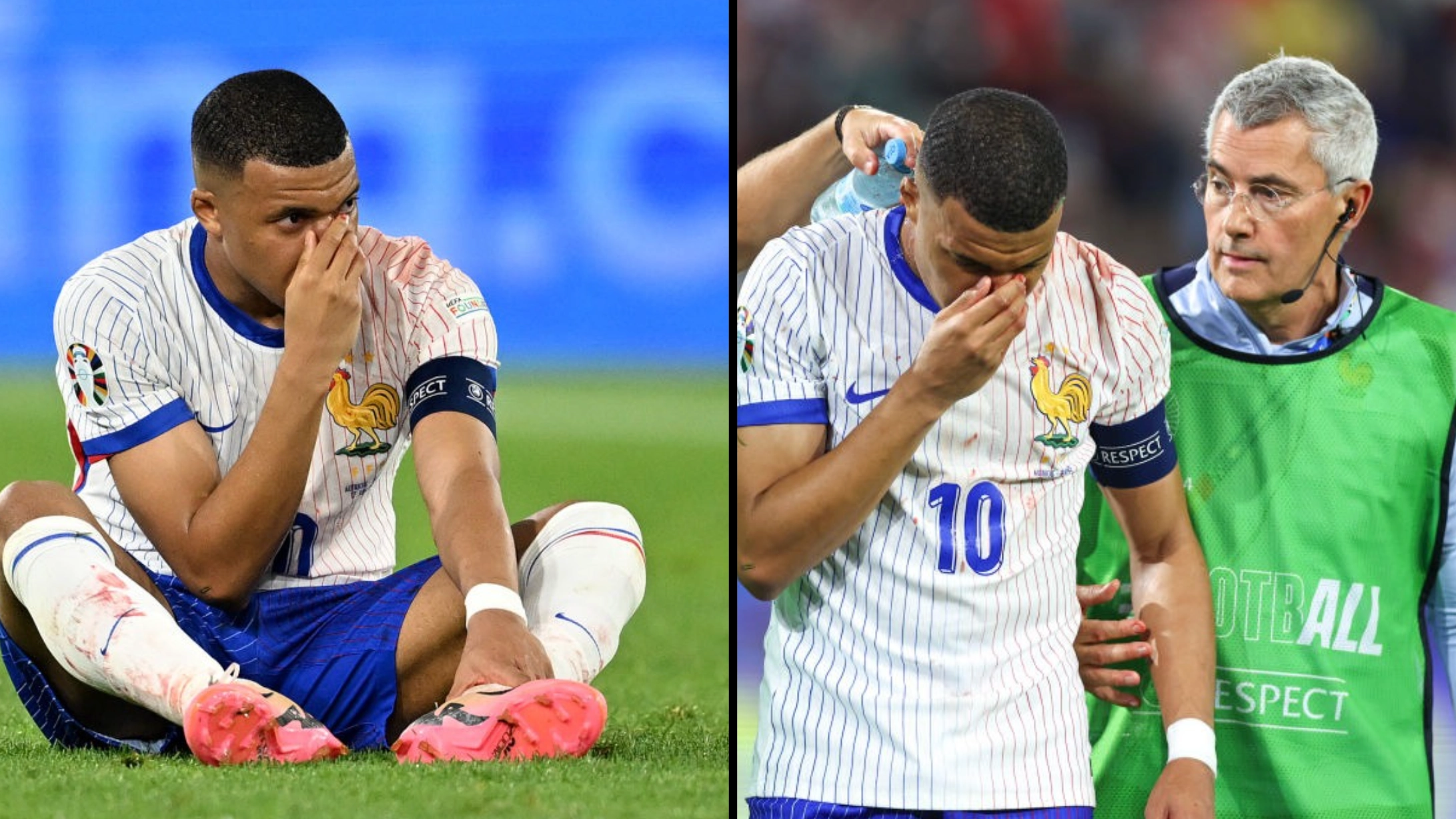 Kylian Mbappe reveals unique thing he might use to keep playing after breaking nose in Euros game