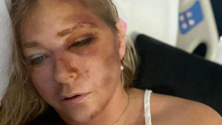 Police reveal new details as Prince Andrew's accuser Virginia Giuffre says she has 'days to live' after crash