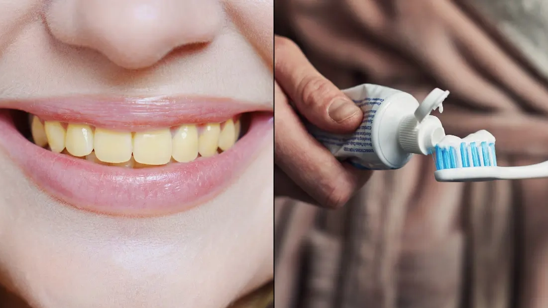There's one reason your teeth will start to go yellow over time that you might not be able to avoid