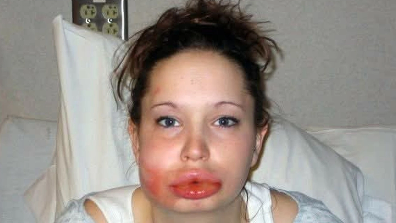 Woman shares horrific photos of burnt face after dangerous 'chroming' trend made her pass out