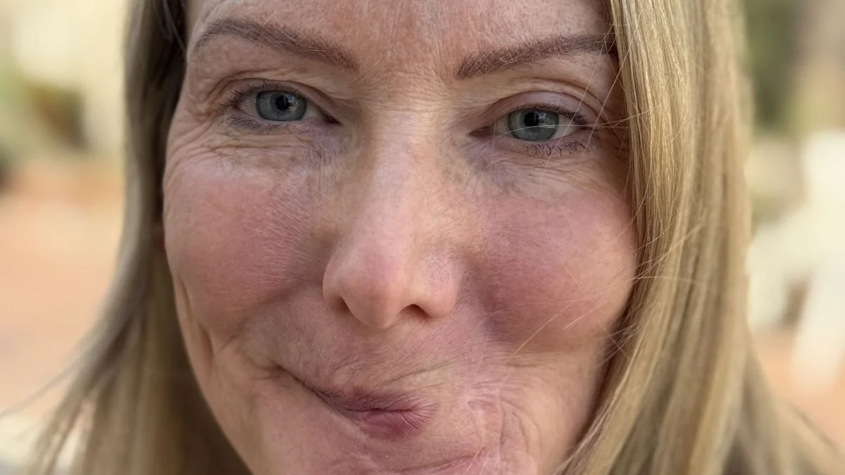 Woman's date ends in horror after she pets stranger's dog and gets lips ripped off