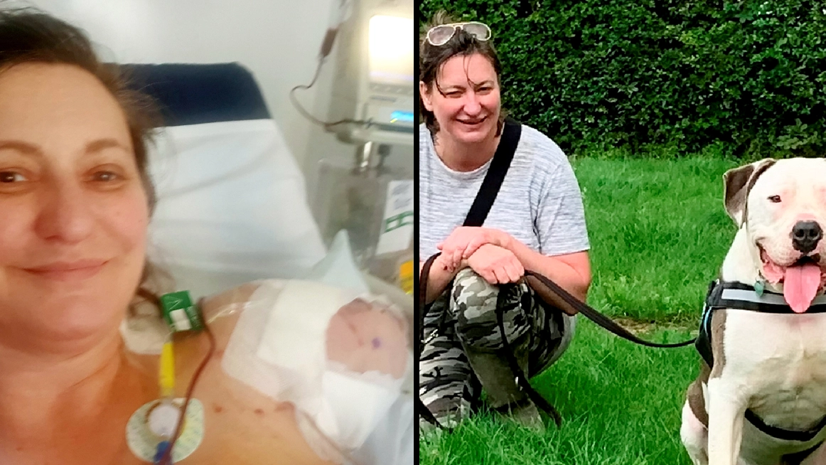 Dog owner who lost arm after American Bulldog mauled her is suing RSPCA for £200,000