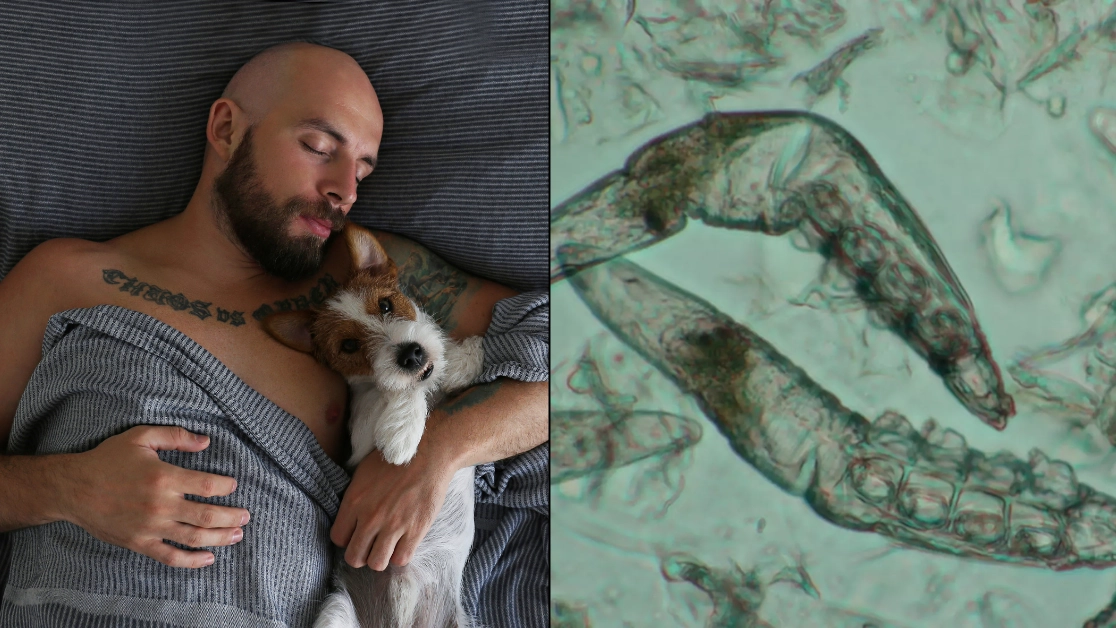 How to avoid parasitic eye infection caught by common bedroom habit that millions of people do