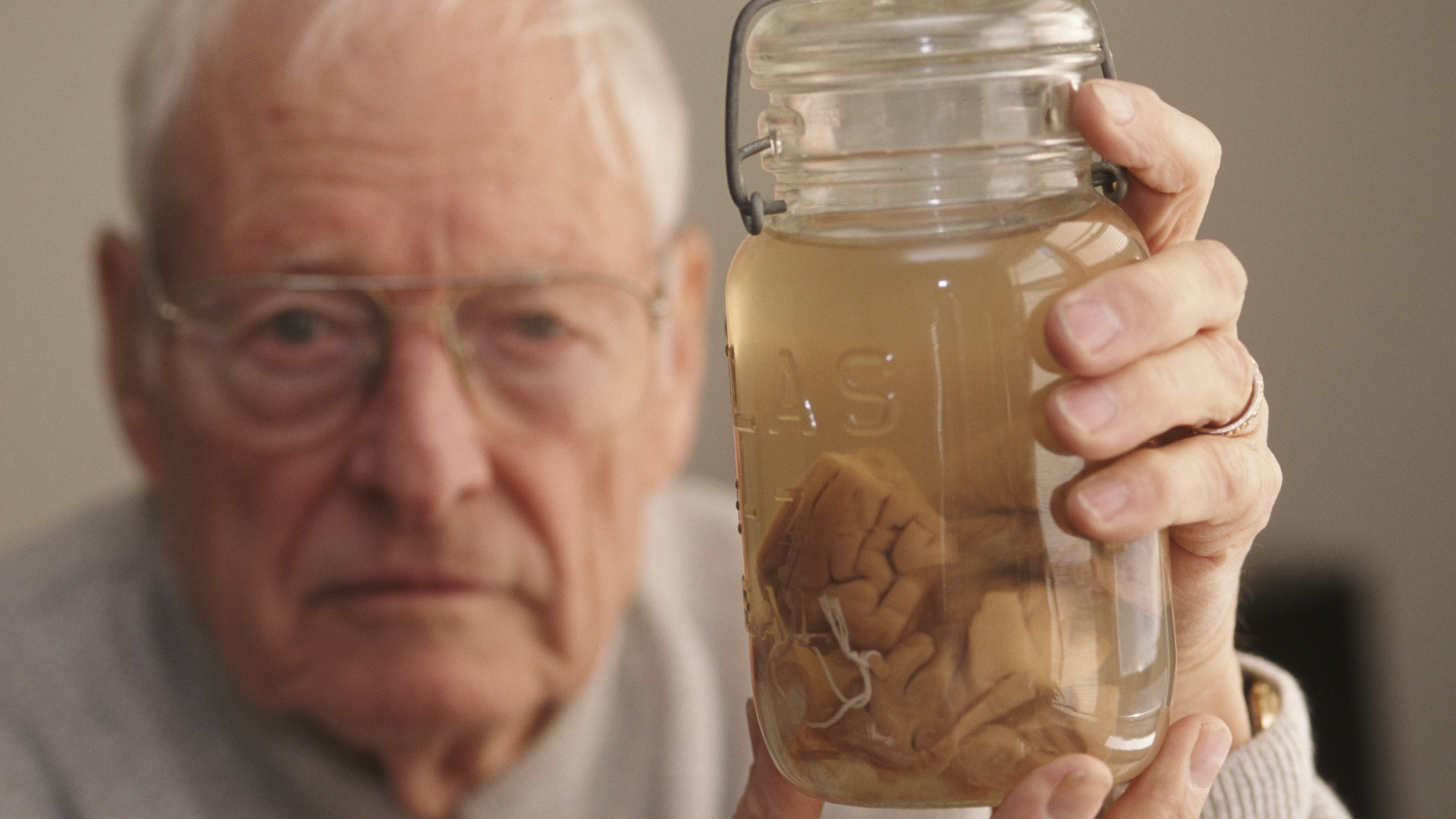 Haunting simulation shows how doctor managed to steal part of Einstein's brain and carry it around for 50 years