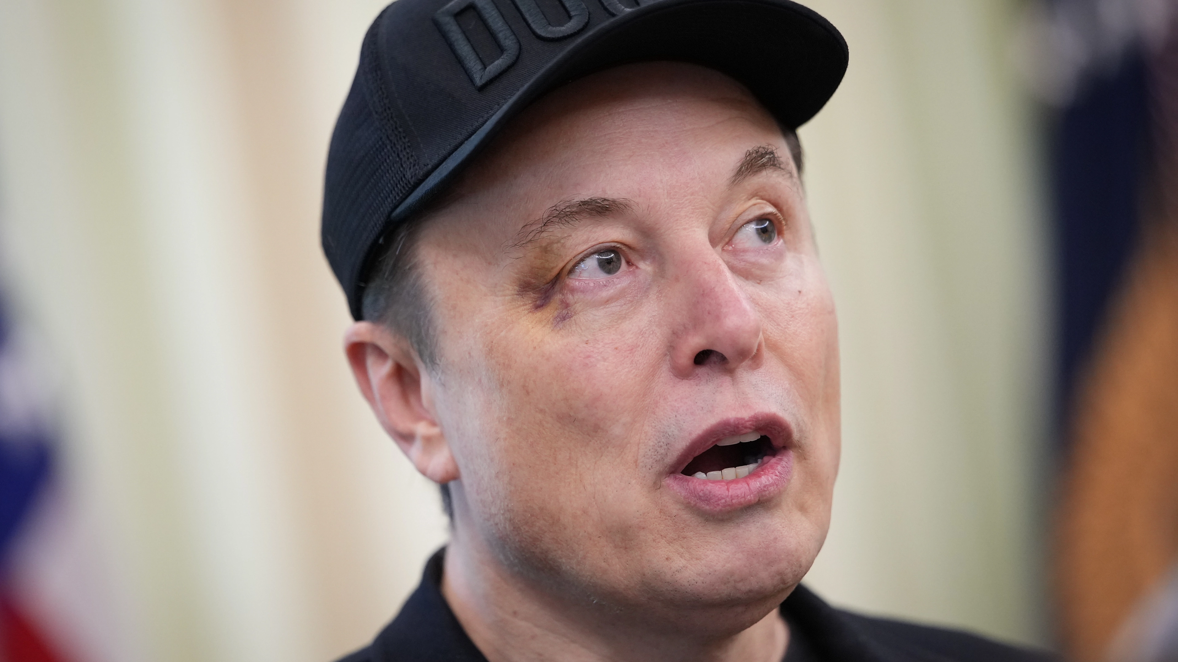 Elon Musk turns up to farewell press conference with black eye revealing how he got it