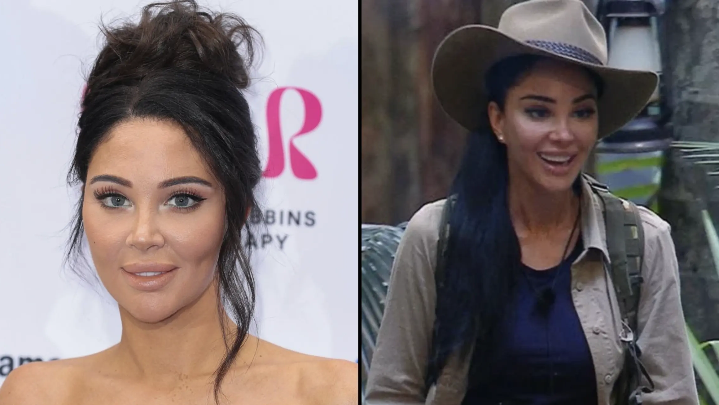 I’m A Celeb's Tulisa has revealed heartbreaking reason behind getting cosmetic facial surgery