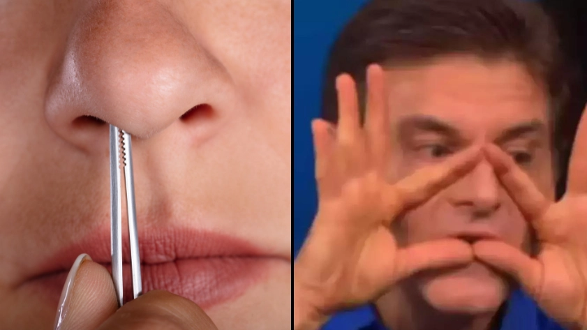 Doctor warns against plucking nose hair if you want to avoid the 'triangle of death'
