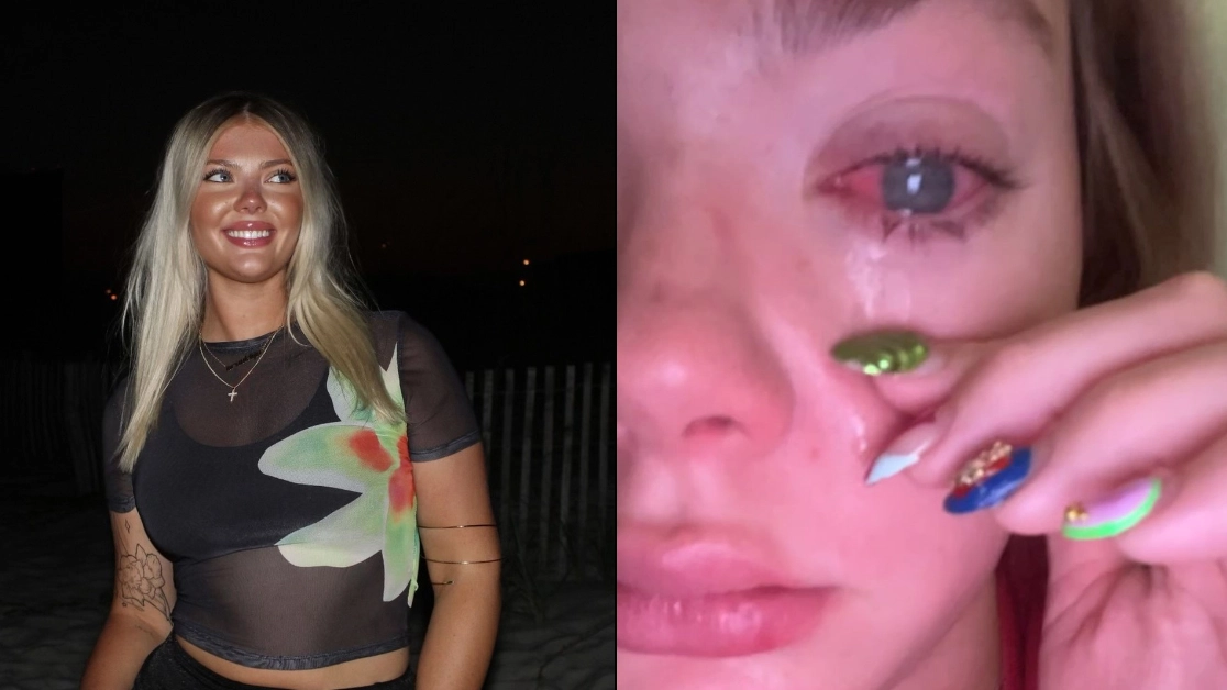 Woman who thought she had sand in her eye loses sight in it after making horrific discovery