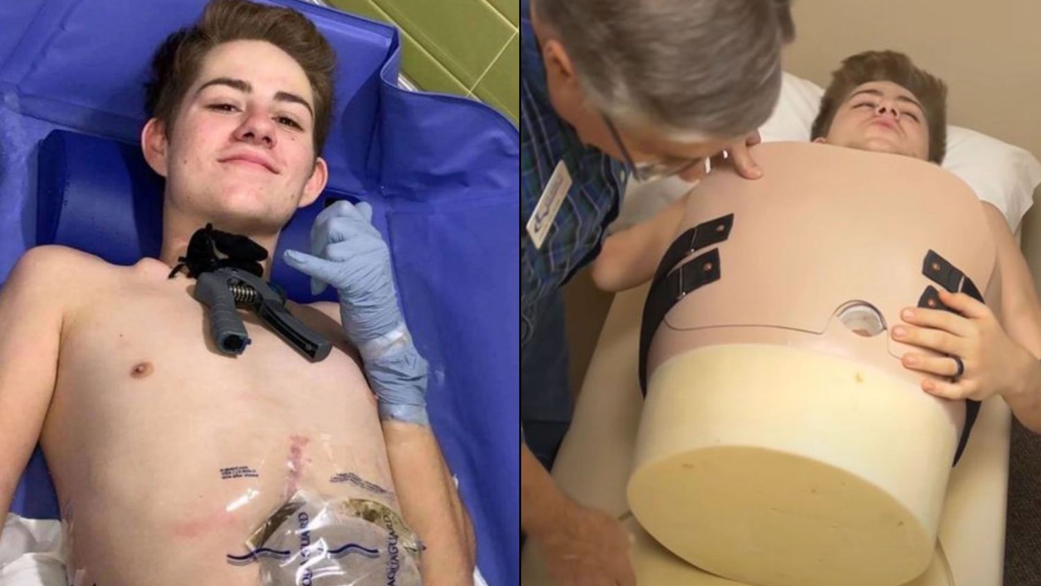 Man who was cut in half by forklift explains how he 'poops, pees and farts'