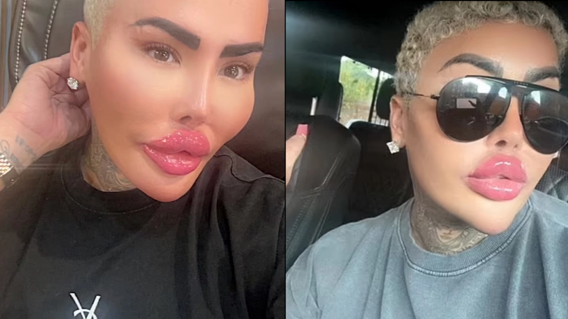 TV star known as 'The Lip King' arrested over mum's death after BBL procedure in UK
