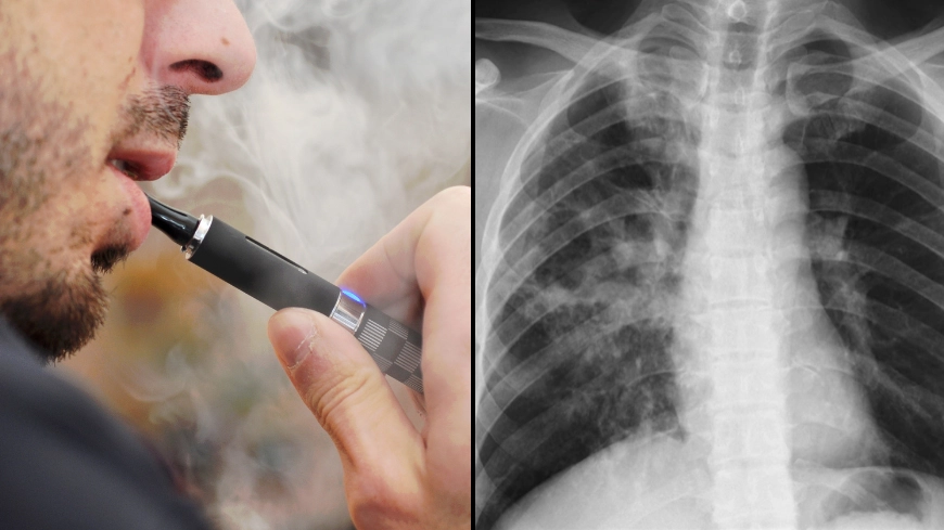Timeline of what happens to your body when you quit vaping 