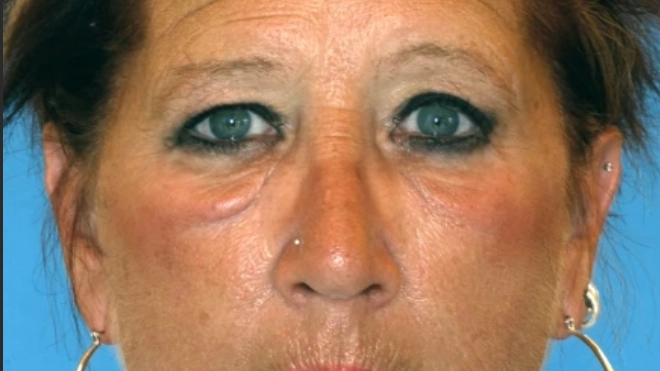 Identical twins shared huge impact after one smoked for 15 years and other didn’t
