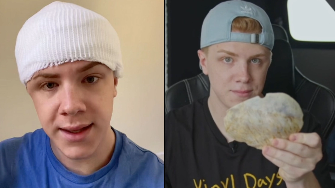 Mystery as man left with half a skull has no idea what happened to him