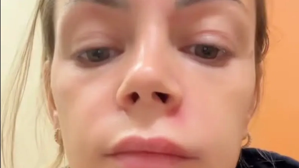 Woman issues warning after popping spot in ‘triangle of death’ that left her in urgent care