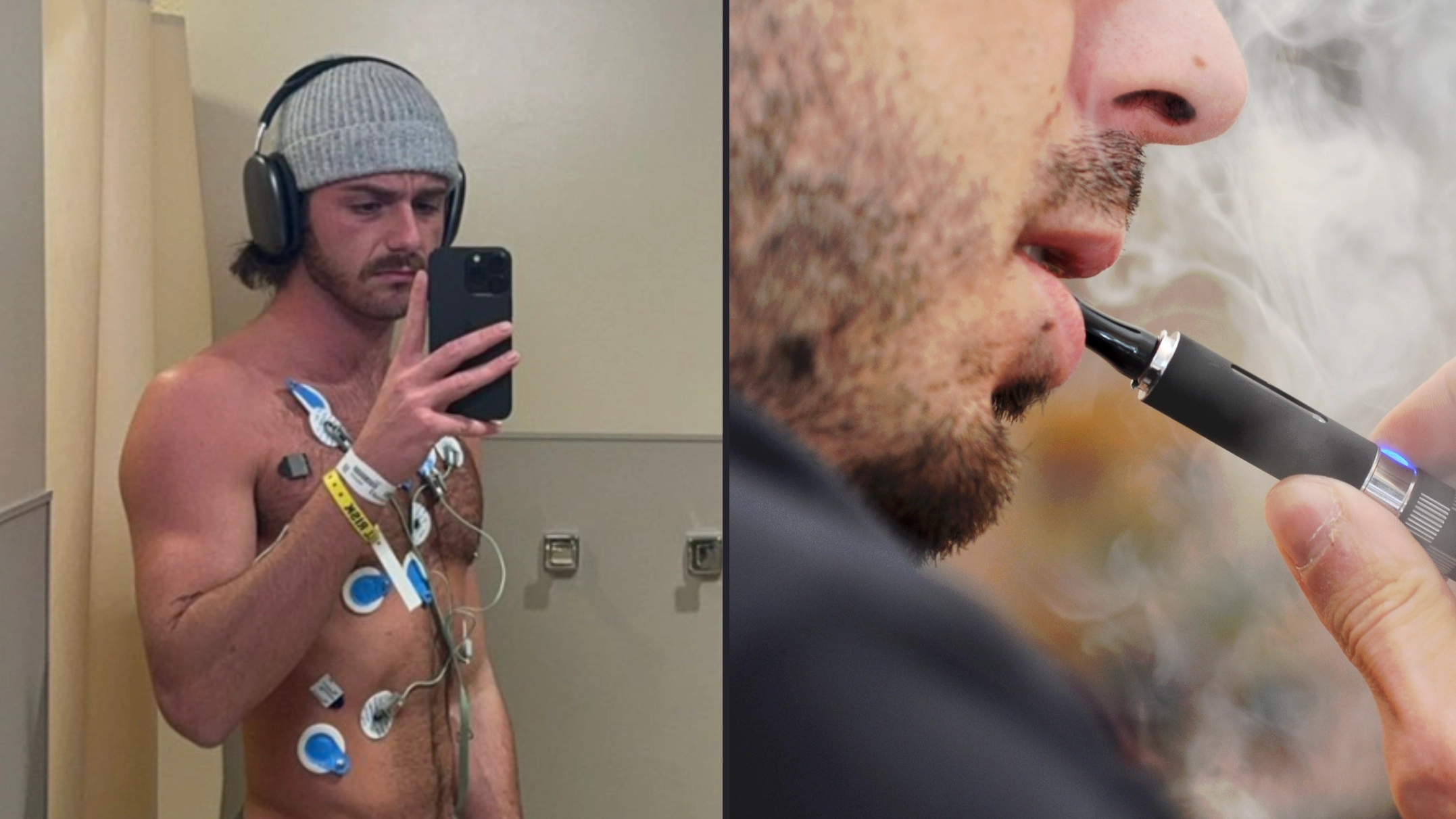 Man who vaped every day for years posts photo of himself as a harrowing warning to others