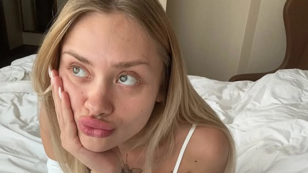 Model left with broken spine and legs after Dubai ‘porta potty’ party makes comeback