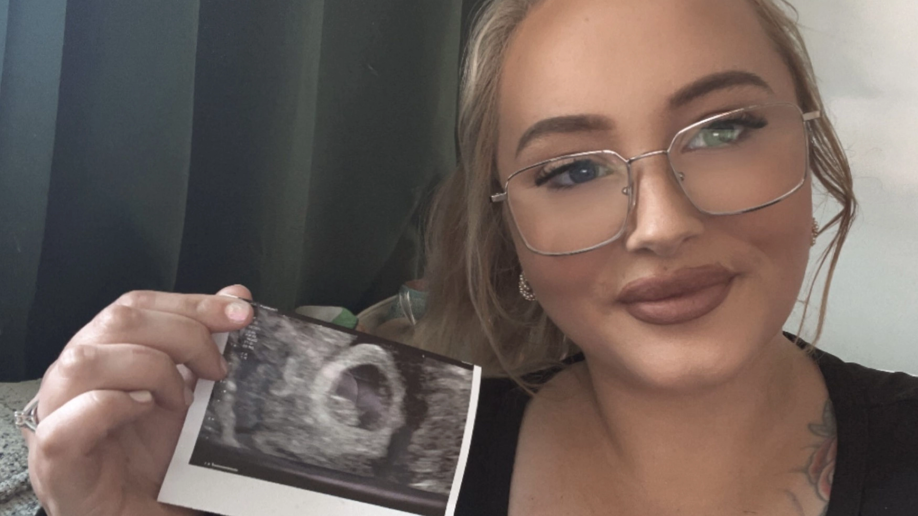 Woman's warning after getting pregnant on popular weight loss drug while taking the pill