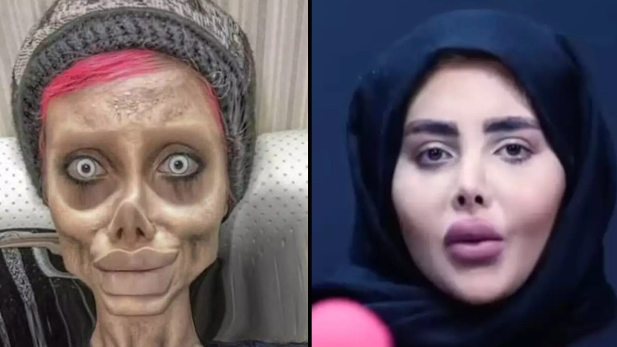 Woman went to extreme lengths to turn into 'zombie Angelina Jolie' before getting jailed