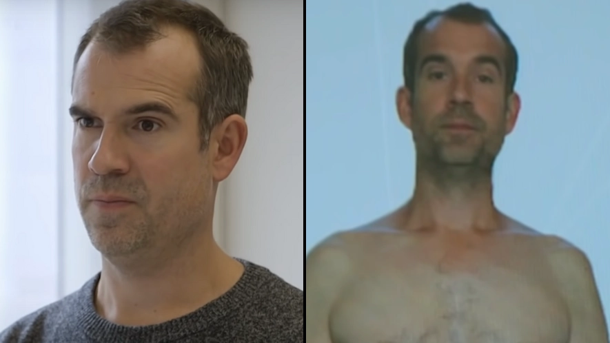 Doctor who switched to 80% ultra-processed food diet for 30 days revealed shocking before and after results