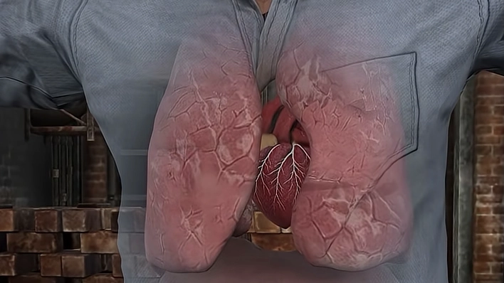 Simulation shows how weed affects your body as former addict shares what happened when he stopped