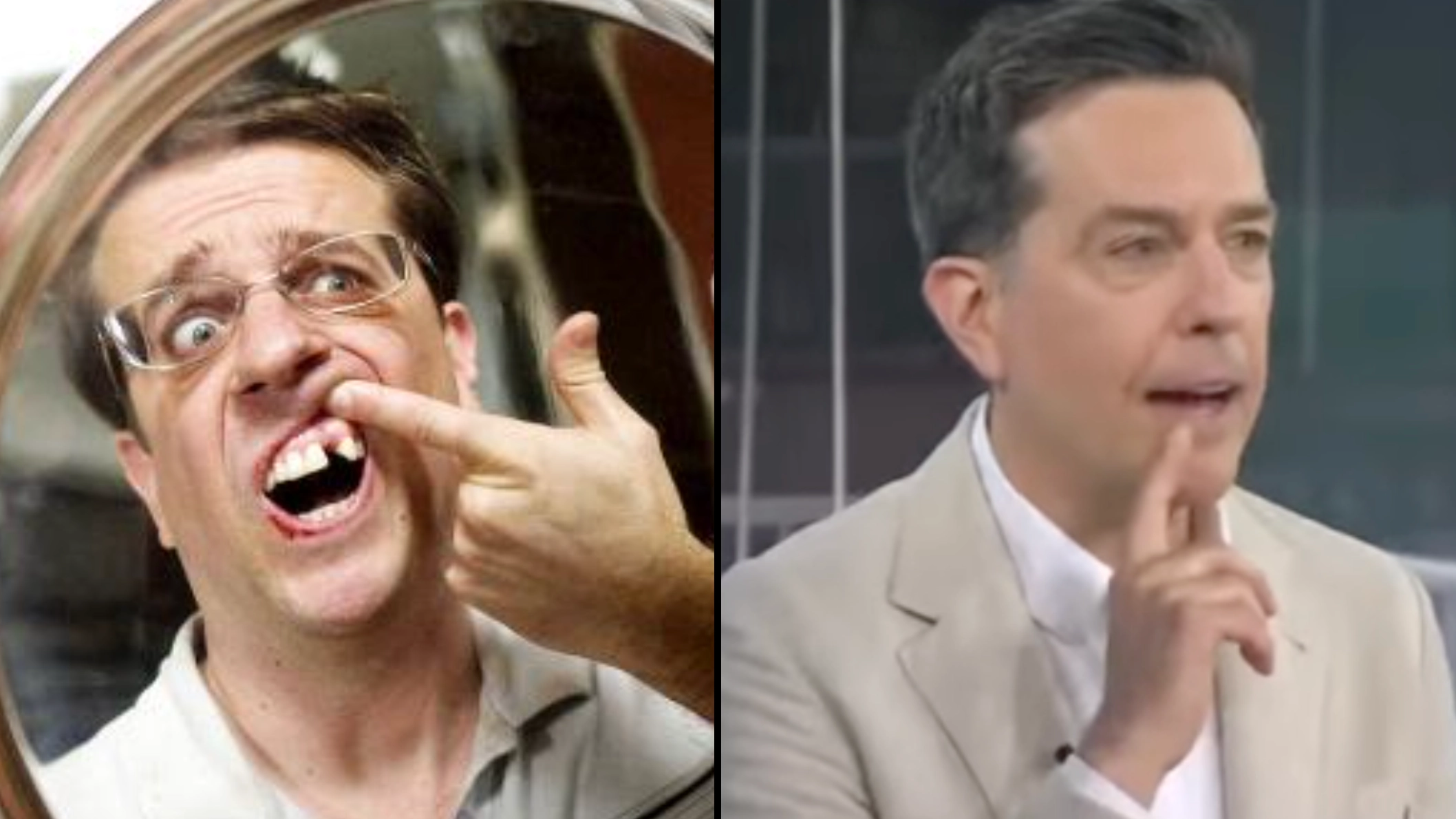 Ed Helms removed his actual tooth for role in The Hangover