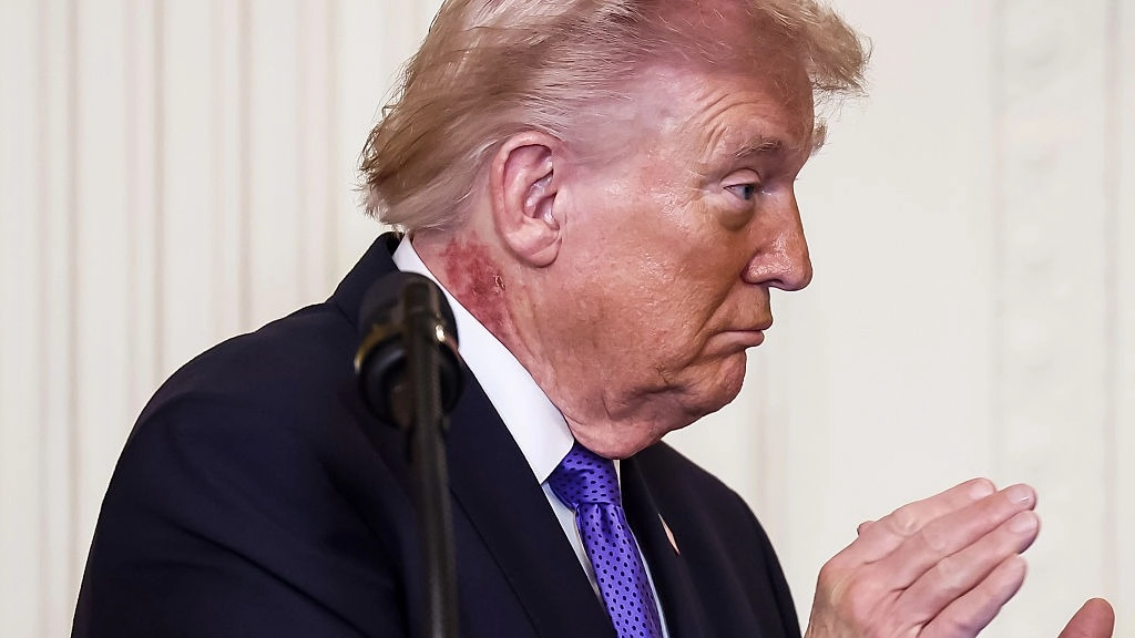 The White House explains what is causing large scabbing rash on Trump's neck